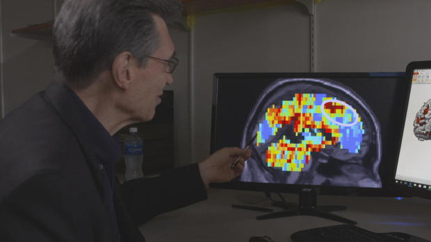 Dr. Marcel Just with an fMRI brain scan.